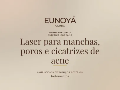Laser para manchas, poros e cicatrizes de acne: quais são as diferenças entre os tratamentos